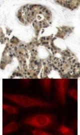 4E BP1 (Ab 45) Antibody