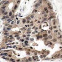 4E BP1 (Ab 36) Antibody