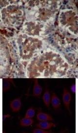 MTOR Antibody