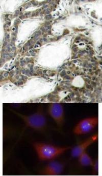 CTNNB1 Antibody