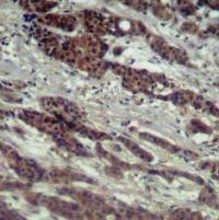 RAF1 Antibody