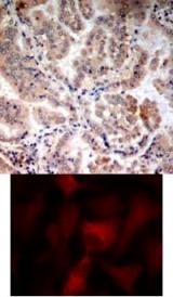 PRKAA1 PRKAA2 Antibody