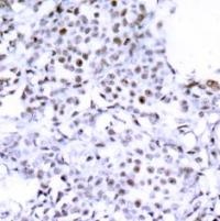 SMC1 (Ab 957) Antibody
