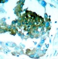 PRKCQ Antibody