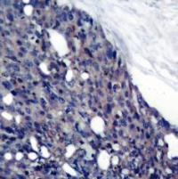 NFKBIA Antibody