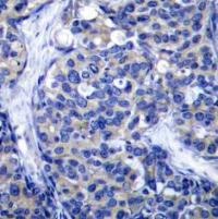 ZAP70 Antibody