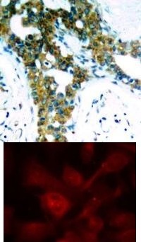 PAK1 / PAK2 / PAK3 (Ab 423 / 402 / 421) Antibody