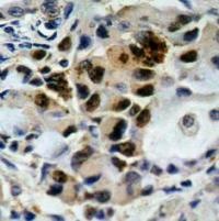 FOXO4 Antibody