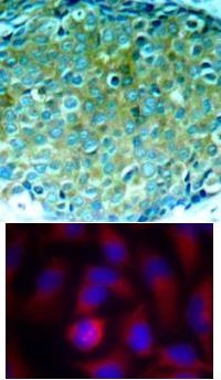 PAK1 Antibody