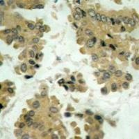 Akt2 (Ab 474) Antibody