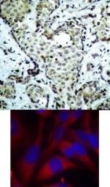 MAP2K6 Antibody