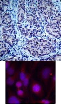 HDAC2 (Ab 394) Antibody