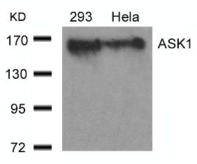 MAP3K5 Antibody