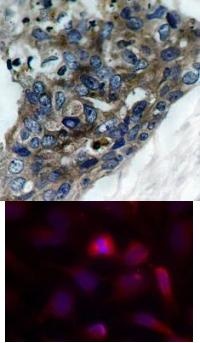 MAP3K5 Antibody