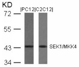 MAP2K4 Antibody