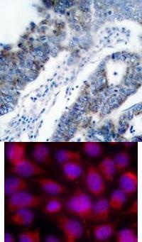 MAP3K5 Antibody
