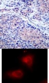 NFKBIA Antibody