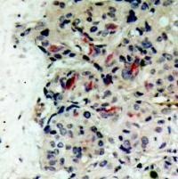JAK1 (Ab 1022) Antibody
