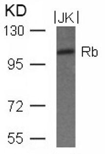 RB1 Antibody