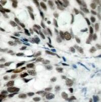 RB1 Antibody