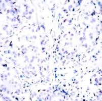 RB1 Antibody
