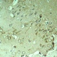 MAPT Antibody