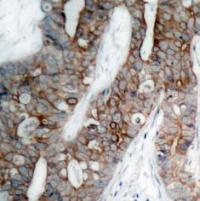 ITGB3 Antibody
