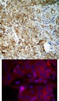 IGF1R Antibody