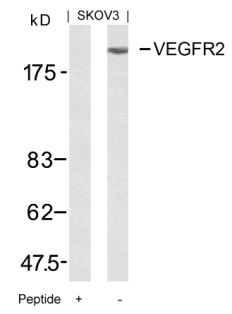 KDR Antibody