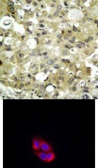 KDR Antibody