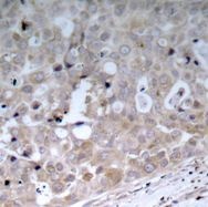 KDR Antibody