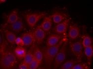 KDR Antibody