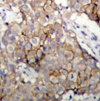 EGFR Antibody