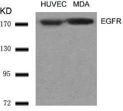 EGFR (Ab 1070) Antibody