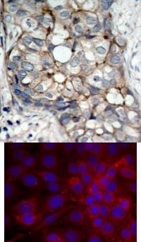 EGFR (Ab 1070) Antibody