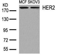 ERBB2 Antibody