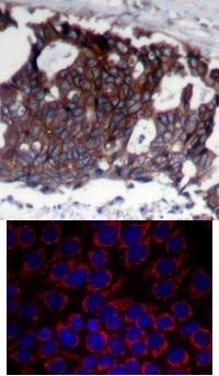 ERBB2 Antibody