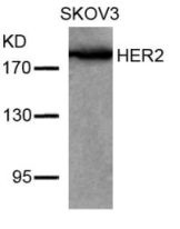 ERBB2 Antibody