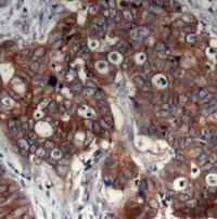 ERBB2 Antibody