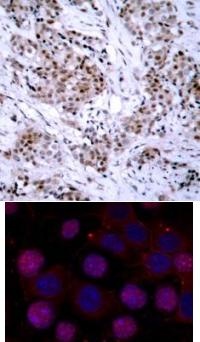 ESR1 Antibody