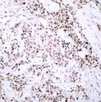 ESR1 Antibody