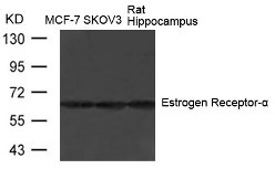 ESR1 Antibody