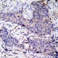 BAD Antibody