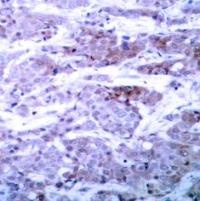 BAD (Ab 112) Antibody