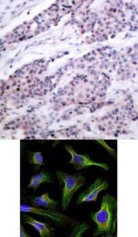BCL2 Antibody