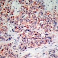 PTEN Antibody