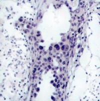 PTEN Antibody