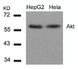 AKT1 Antibody