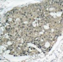 AKT1 Antibody