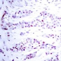 STAT6 Antibody